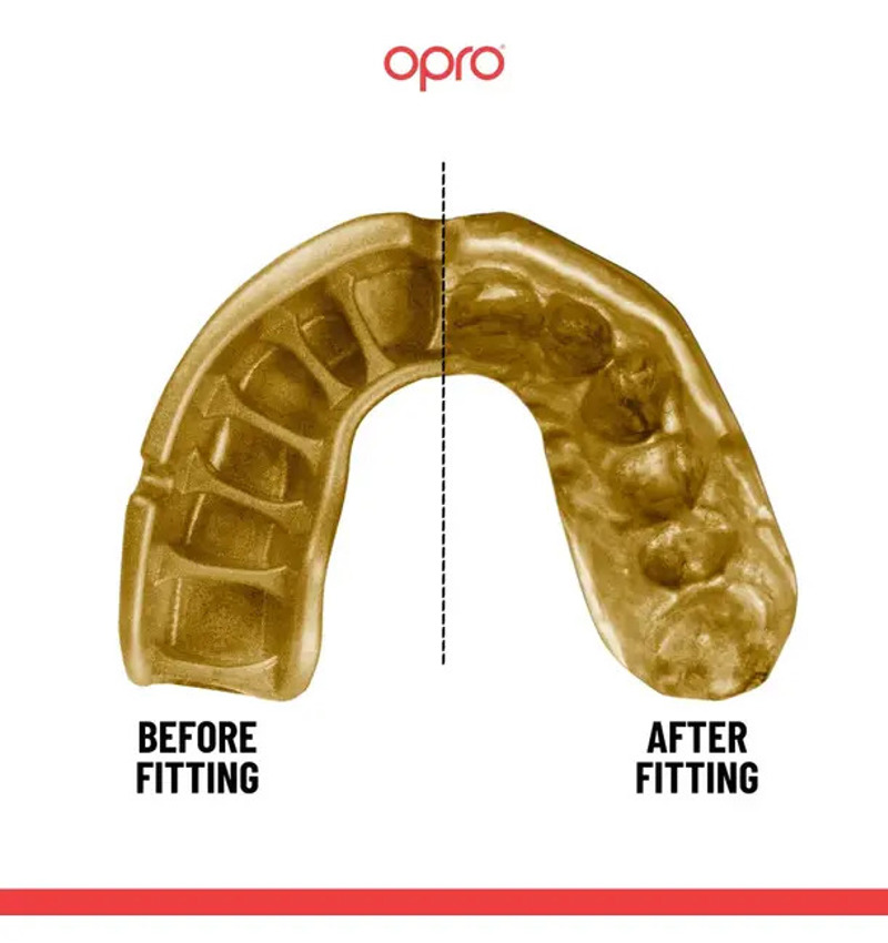 Opro GOLD series GEN5 Prostateftiki masela ENILIKON -clear